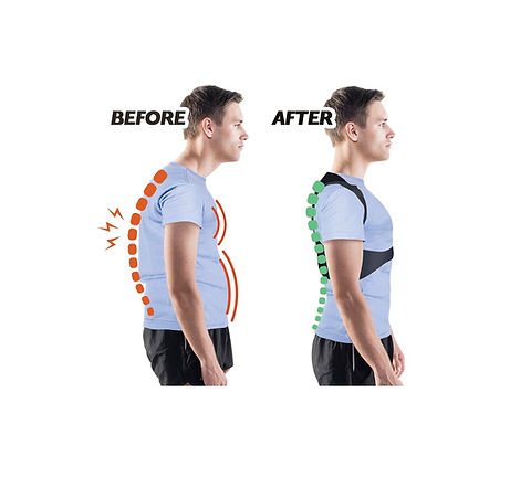 Comfortisse Posture Pro posture corrector